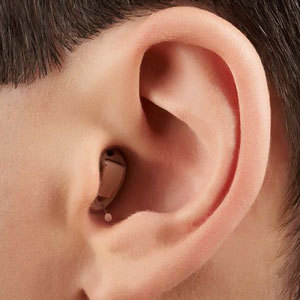 Completely-In-Canal Hearing Aid (CIC)